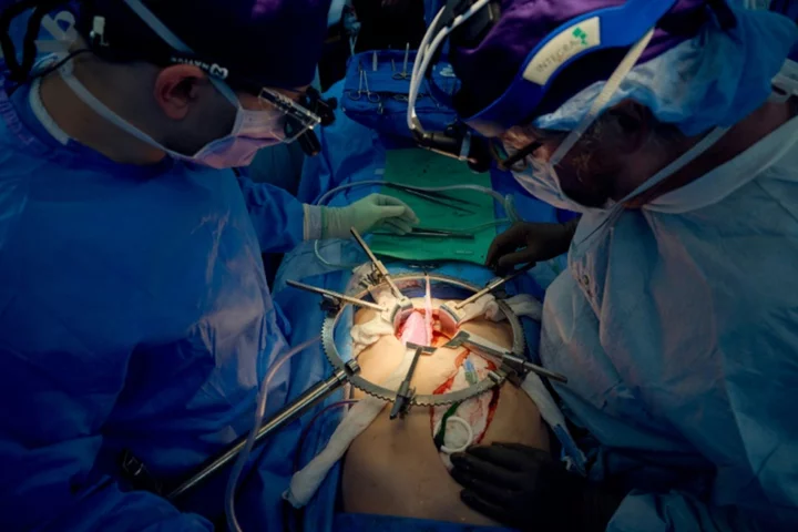 US surgeons report longest successful pig-to-human kidney transplant